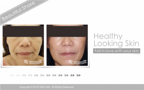 Beautiful Share,MIRALLER,Skin Regenerating,Hydrating Moisturizer