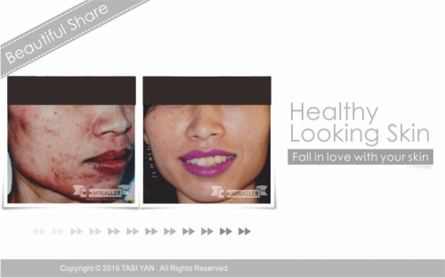 Beautiful Share,MIRALLER,Skin Regenerating,Hydrating Moisturizer