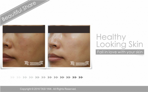 Beautiful Share,MIRALLER,Skin Regenerating,Hydrating Moisturizer