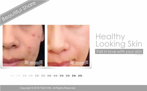 Beautiful Share,MIRALLER,Skin Regenerating,Hydrating Moisturizer