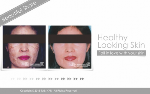 Beautiful Share,MIRALLER,Skin Regenerating,Hydrating Moisturizer