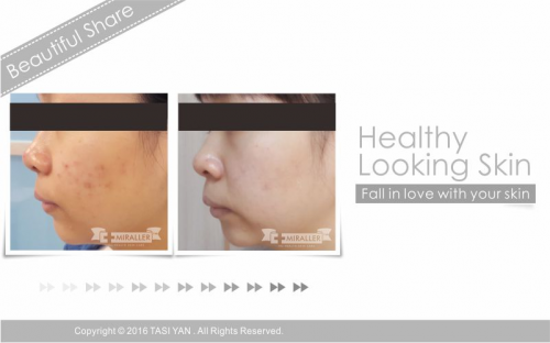 Beautiful Share,MIRALLER,Skin Regenerating,Hydrating Moisturizer