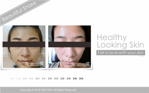 Beautiful Share,MIRALLER,Skin Regenerating,Hydrating Moisturizer