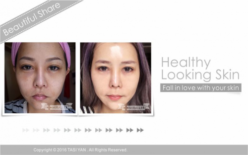 Beautiful Share,MIRALLER,Skin Regenerating,Hydrating Moisturizer