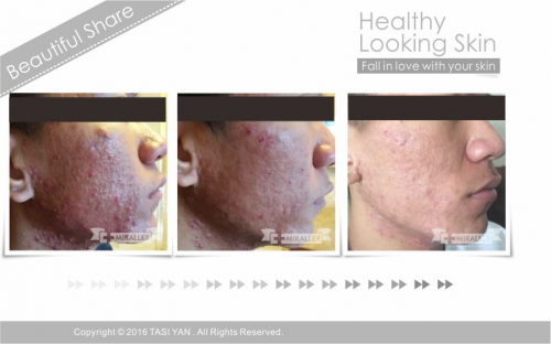 Beautiful Share,MIRALLER,Skin Regenerating,Hydrating Moisturizer