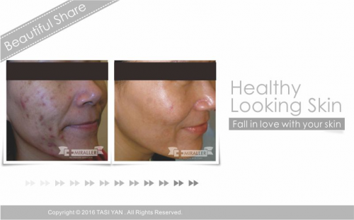 Beautiful Share,MIRALLER,Skin Regenerating,Hydrating Moisturizer