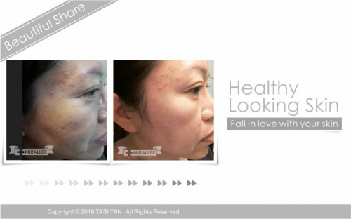 Beautiful Share,MIRALLER,Skin Regenerating,Hydrating Moisturizer