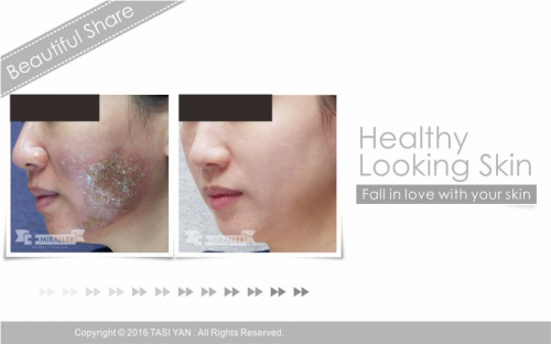 Beautiful Share,MIRALLER,Skin Regenerating,Hydrating Moisturizer