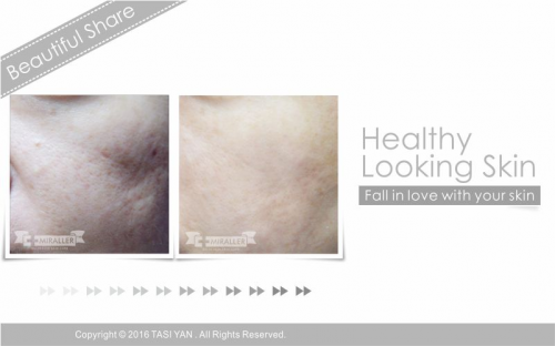 Beautiful Share,MIRALLER,Skin Regenerating,Hydrating Moisturizer