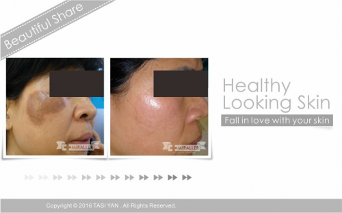 Beautiful Share,MIRALLER,Skin Regenerating,Hydrating Moisturizer