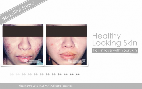 Beautiful Share,MIRALLER,Skin Regenerating,Hydrating Moisturizer