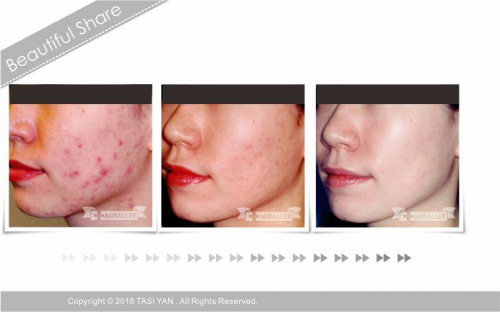 Beautiful Share,MIRALLER,Skin Regenerating,Hydrating Moisturizer